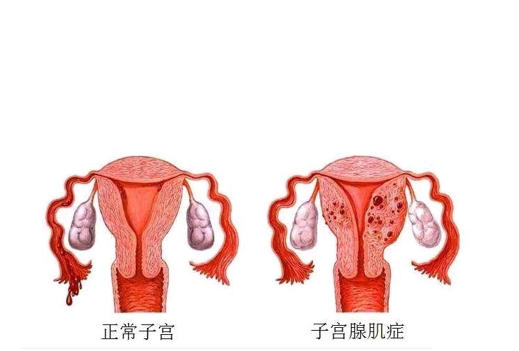 做借卵三代供卵试管是什么样做借卵供卵代生自怀是什么意思