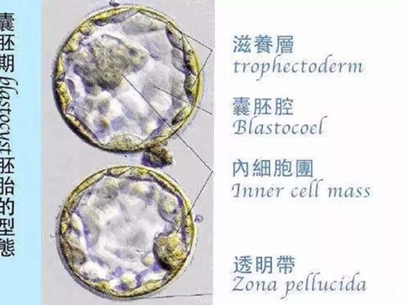计算新鲜胚胎3天做借卵三代自怀试管移植的预产期最准确的算法是什么？