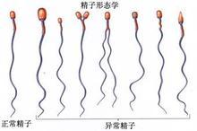 北京供卵试管婴儿医院价格