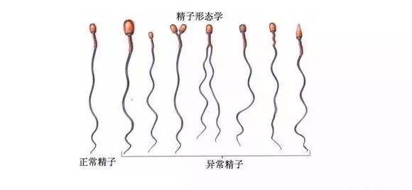 多囊适合促排还是做借卵试管