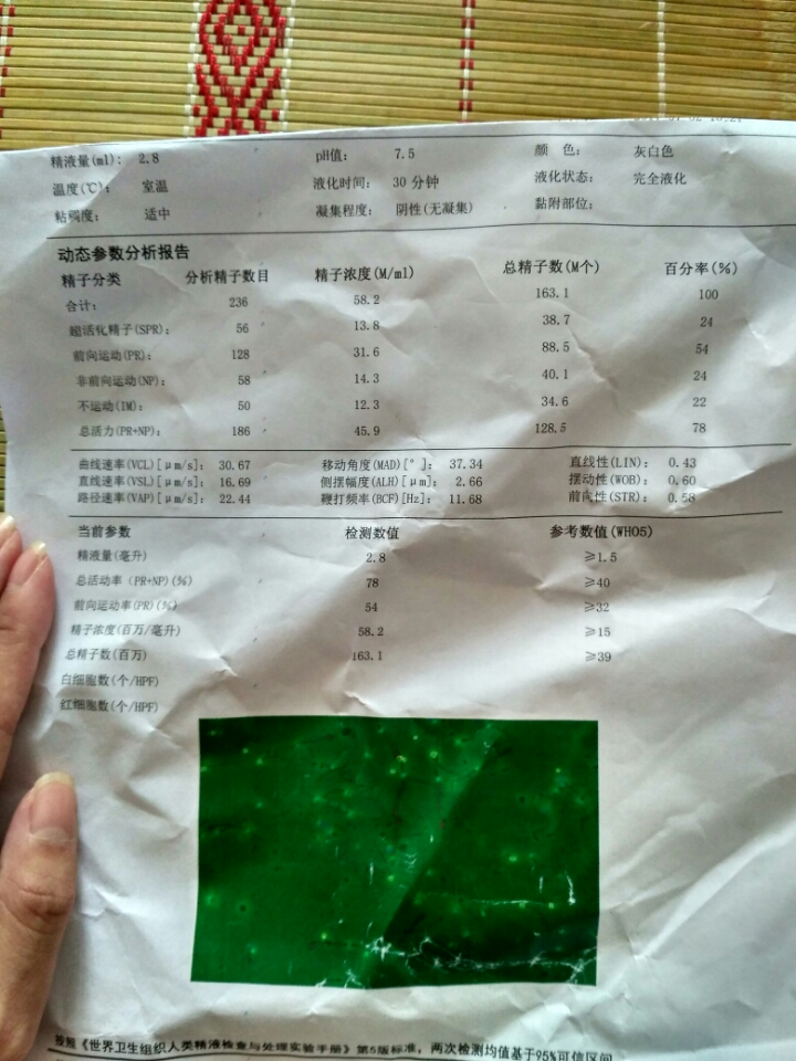 借卵做赠卵试管医院北京