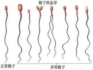 北京174医院试管婴儿成功率高吗