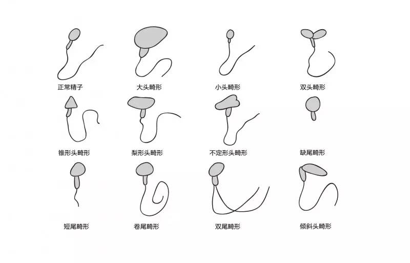 无卵试管费用高吗
