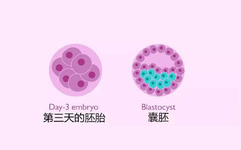 试管婴儿技术有什么负面影响