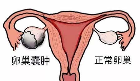 试管检查经期的检查有哪些