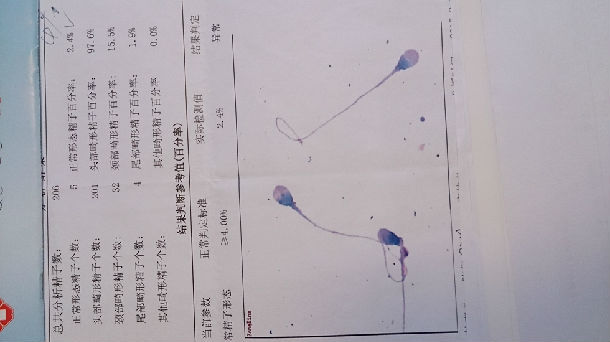 男性无精子症可以做北京试管吗？无精症怎么做试管才能怀孕？