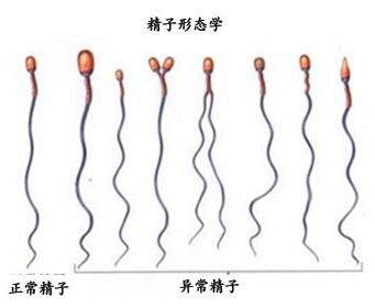卵巢功能对国内供卵代生子成功率影响大吗？