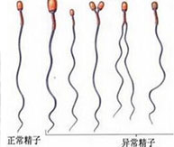 夫妻先天缺陷,到北京市供卵试管生子机构婴儿孩子会健康吗