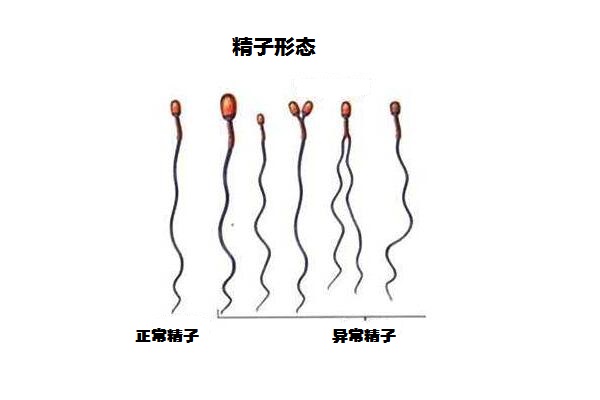 大学生代生什么价需要检查宫颈吗+宫颈刮片是检查什么