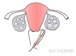 北京孙逸仙纪念医院借卵试管代怀咨询怎么样