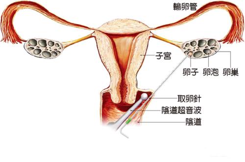 北京市省中助孕机构公司婴儿移植鲜胚的成功率怎么样