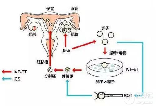 「促排」试管女性需要检查什么_甲流疫苗反作用层出不穷,接种前4大留意事项须知